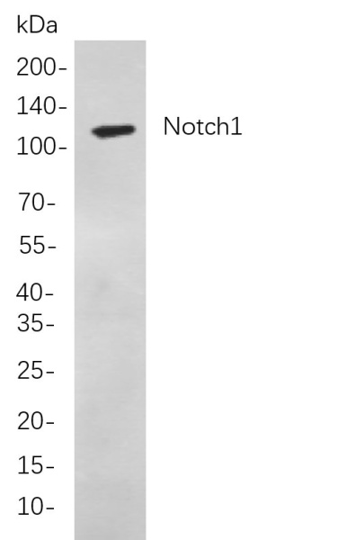 Recombinant Notch1 Monoclonal Antibody (AN301057L)