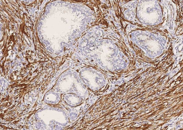 Recombinant MYH11 Monoclonal Antibody (AN300298P)