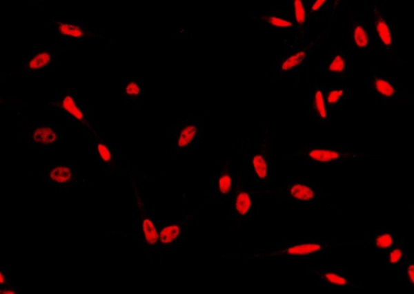 Recombinant HSF1 Monoclonal Antibody (AN300159P)