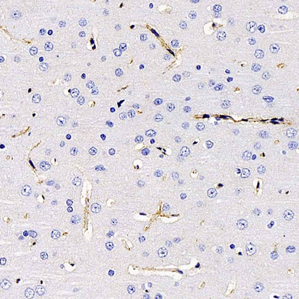 AQP4 Polyclonal Antibody (E-AB-70277)