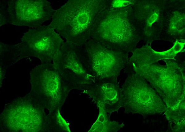 Recombinant UCHL1/PGP9.5 Monoclonal Antibody (AN300102P)