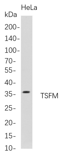 Recombinant TSFM Monoclonal Antibody (AN300773L)