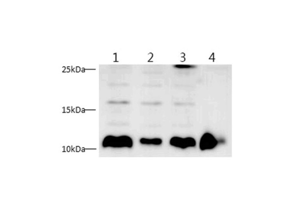 S100A4 Polyclonal Antibody (E-AB-40458)