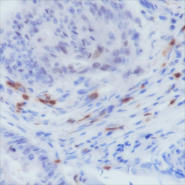 Recombinant CD103 Monoclonal Antibody (AN301460L)
