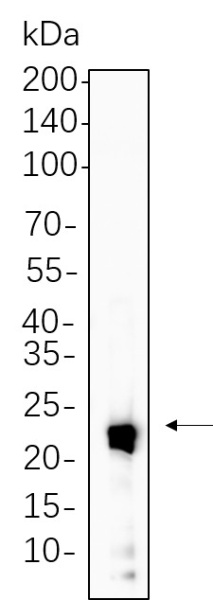 Recombinant IL-10 Monoclonal Antibody (AN300799L)