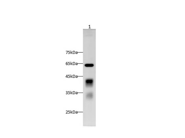 Clusterin Polyclonal Antibody (AN005940L)