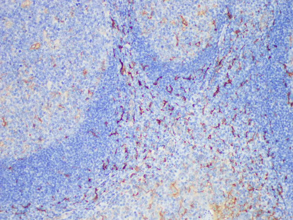 Fascin Monoclonal Antibody (ELAB6632-M)