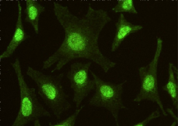 IRF6 Monoclonal Antibody (AN200157P)