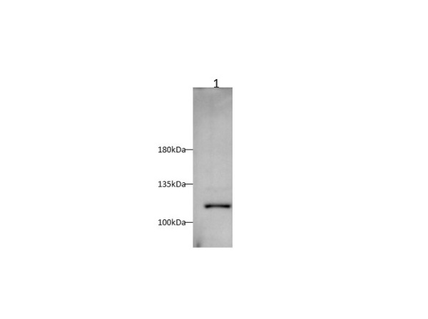 PIK3CA Polyclonal Antibody (D-AB-10260L)