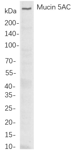 Recombinant Mucin 5AC Monoclonal Antibody (AN301037L)
