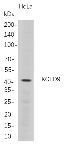 Recombinant KCTD9 Monoclonal Antibody (AN300760L)