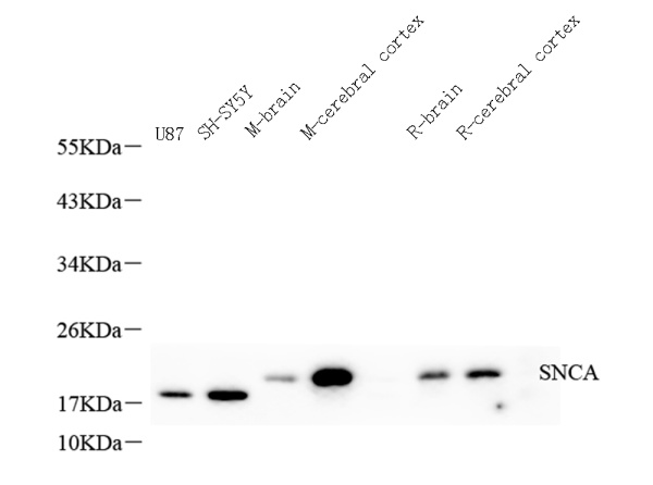 SNCA Polyclonal Antibody (E-AB-70302)