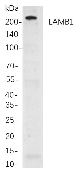 Recombinant LAMB1 Monoclonal Antibody (AN300882L)