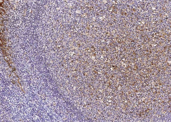 Cystatin A/CSTA Monoclonal Antibody (AN200177P)