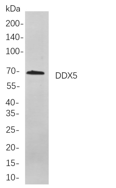 Recombinant DDX5 Monoclonal Antibody (AN300909L)