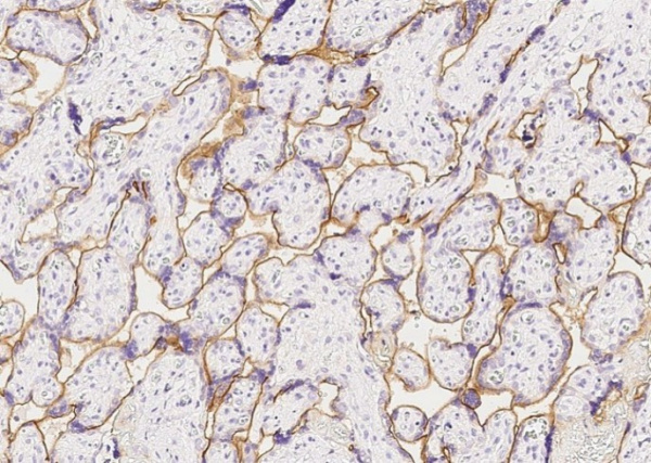 Insulin Receptor/INSR/CD220 Monoclonal Antibody (AN200037P)
