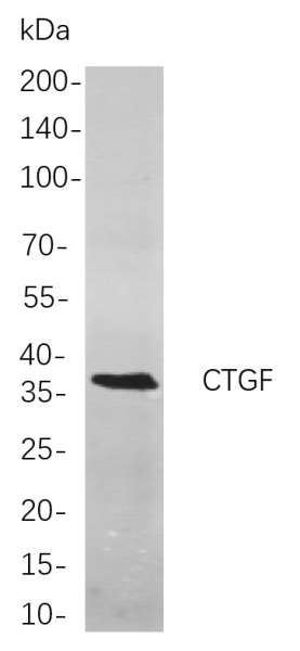 Recombinant CTGF Monoclonal Antibody (AN301048L)