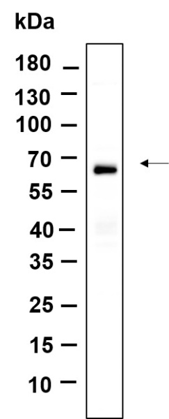 Recombinant BAT5 Monoclonal Antibody (AN301208L)