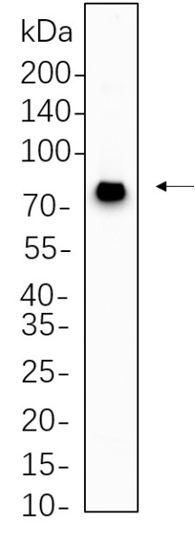 Recombinant MECP2 Monoclonal Antibody (AN300680L)