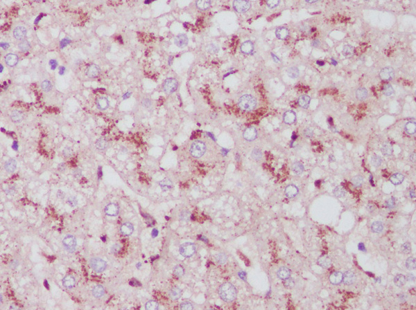 Cathepsin L Polyclonal Antibody (AN007170L)