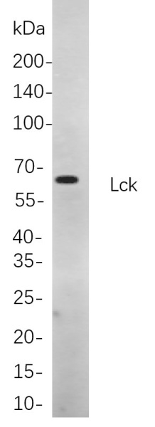 Recombinant Lck Monoclonal Antibody (AN300942L)