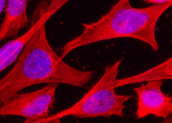 Recombinant HSP70/HSPA1A Monoclonal Antibody (AN300407P)