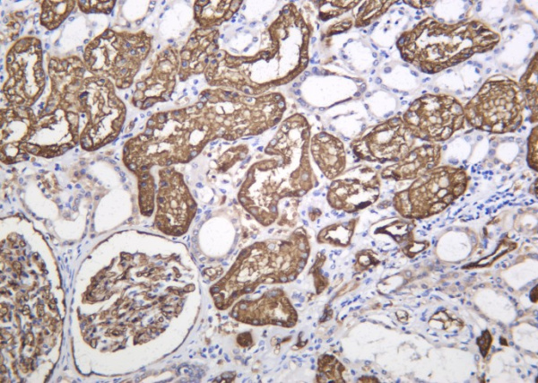 Recombinant AQP1 Monoclonal Antibody (AN301403L)