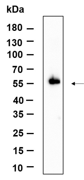 Recombinant STK3 Monoclonal Antibody (AN301190L)