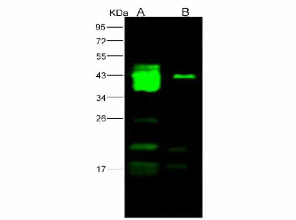 Anti-Ebola virus EBOV(subtype Bundibugyo, strain Uganda 2007) GP1/Glycoprotein Polyclonal Antibody (E-AB-V1104)