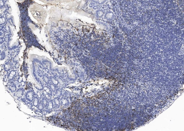 Recombinant CD19 Monoclonal Antibody (AN300527P)