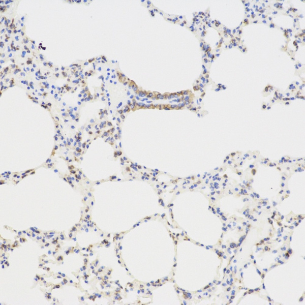 TGFB1 Polyclonal Antibody (E-AB-70076)