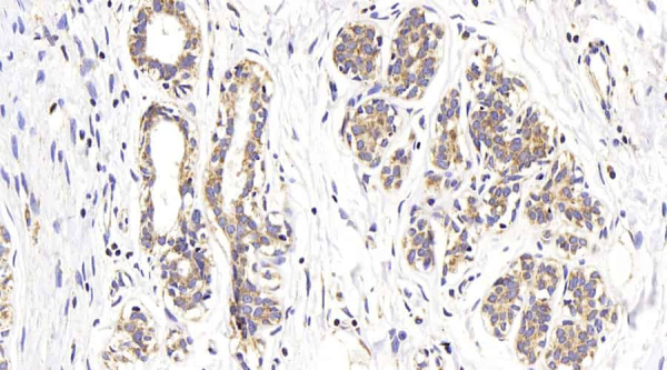ATG7 Polyclonal Antibody (E-AB-70288)