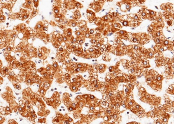 Recombinant Angiotensinogen/SerpinA8/AGT Monoclonal Antibody (AN300214P)