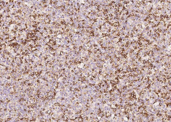 CD45/PTPRC Monoclonal Antibody (AN200168P)