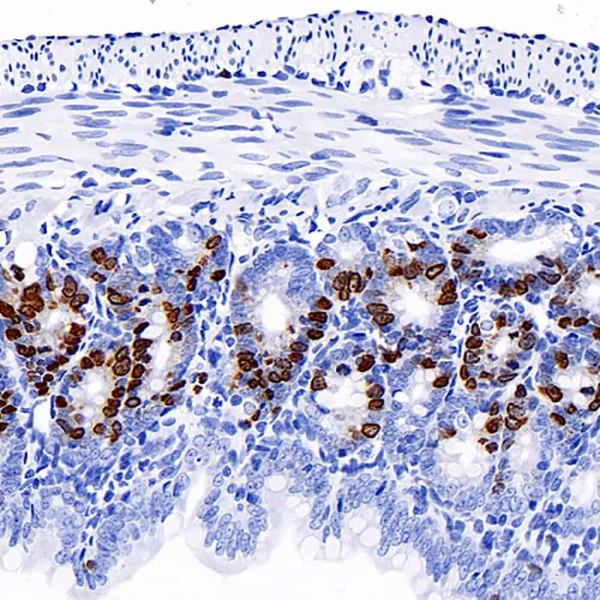 Brdu Monoclonal Antibody (E-AB-70248)
