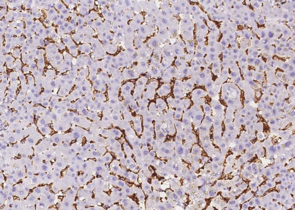 CD16b/FCGR3B Monoclonal Antibody (AN200199P)
