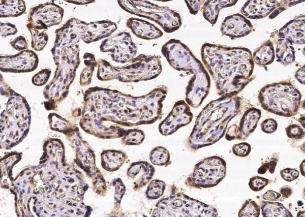CRIP2 Monoclonal Antibody (AN200146P)