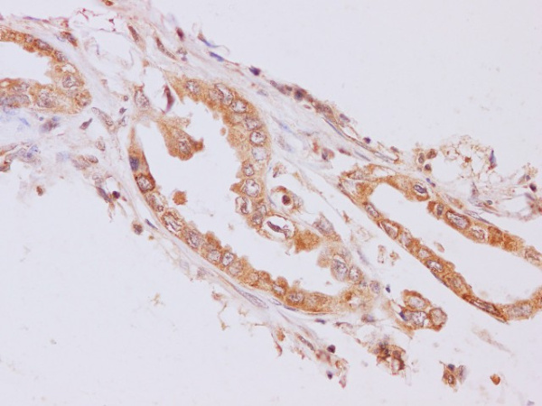 RAB5A Polyclonal Antibody (E-AB-40241)