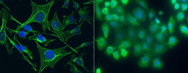 S100A5 Monoclonal Antibody (AN200207P)