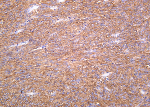 Recombinant TMEM16A Monoclonal Antibody (AN301401L)