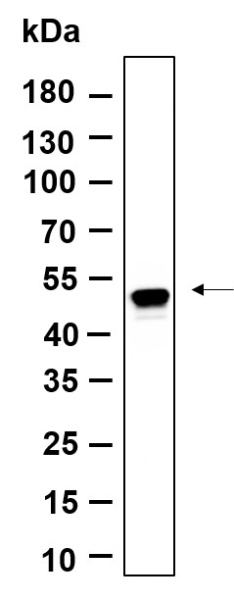 Recombinant Phospho-Smad3 (Ser423, Ser425) Monoclonal Antibody (AN301148L)