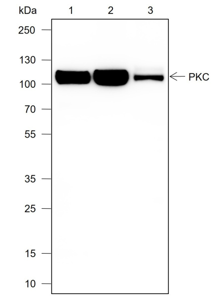 Recombinant PKC mu Monoclonal Antibody (AN301985L)