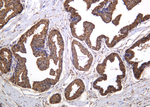 Recombinant ANXA5 Monoclonal Antibody (AN301260L)