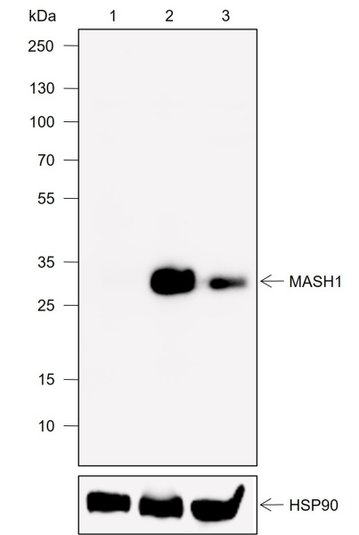 Recombinant MASH1 Monoclonal Antibody (AN301998L)