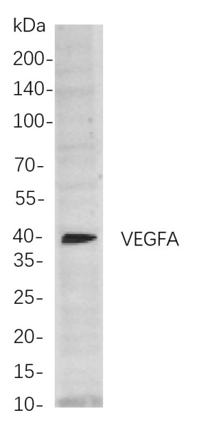 Recombinant VEGFA Monoclonal Antibody (AN300844L)