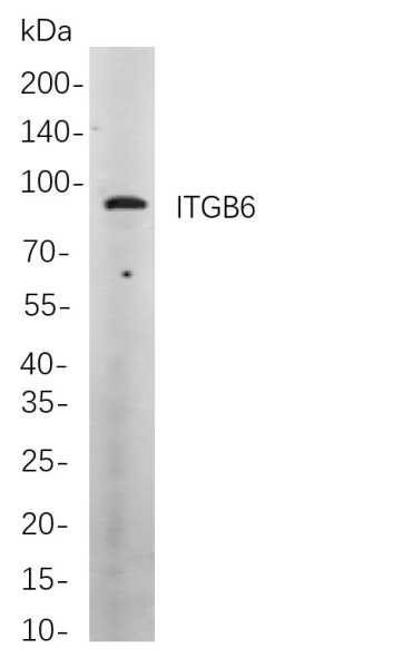 Recombinant ITGB6 Monoclonal Antibody (AN300921L)