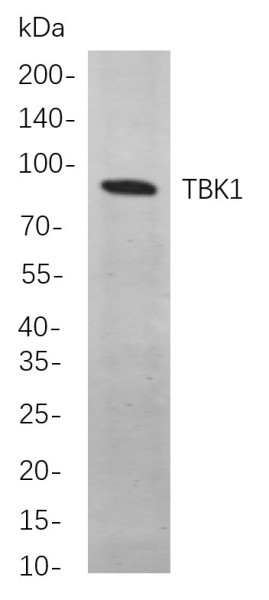 Recombinant TBK1 Monoclonal Antibody (AN300849L)