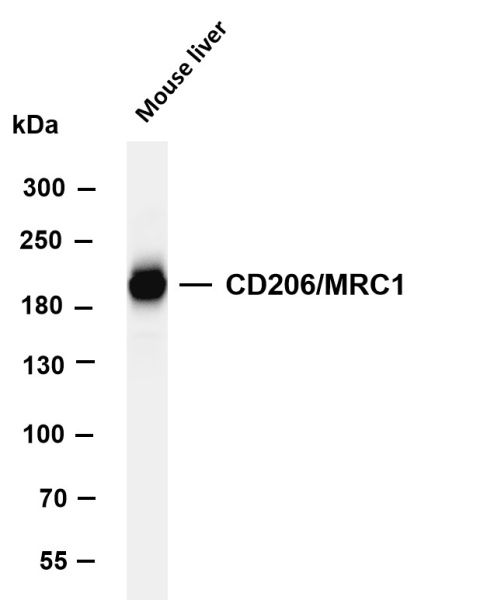 Recombinant CD206/MRC1 Monoclonal Antibody (AN301353L)