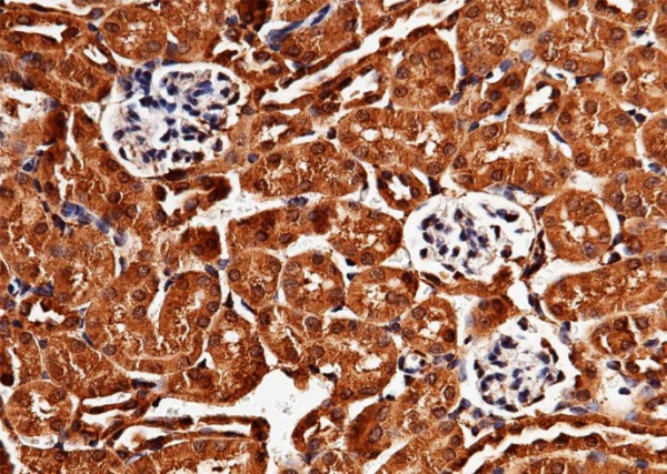 Recombinant LIMP-2/SCARB2/CD36L2 Monoclonal Antibody (AN300466P)