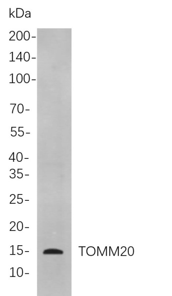 Recombinant TOMM20 Monoclonal Antibody (AN301040L)